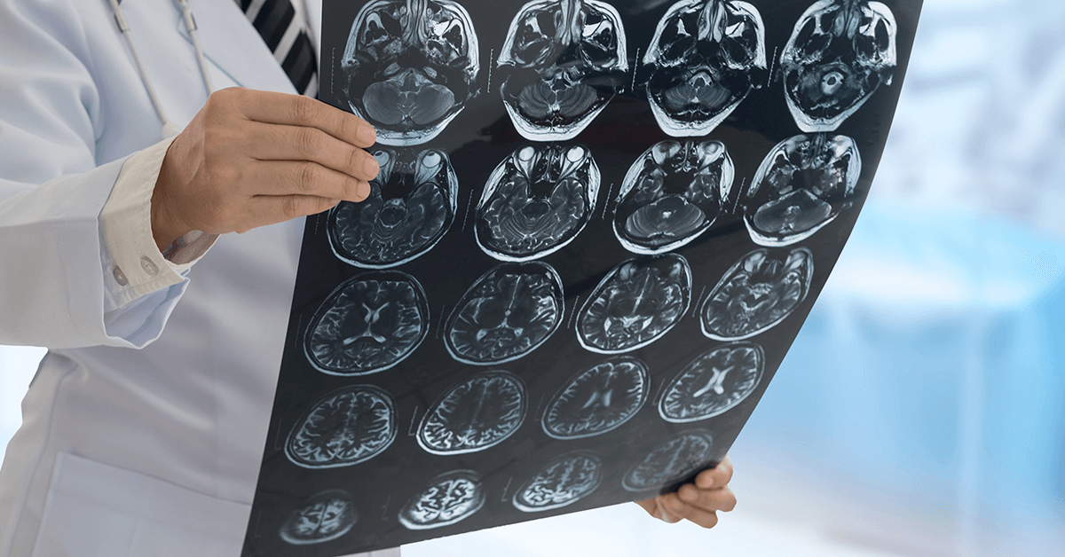 UCE325_TOMOGRAFIA COMPUTADORIZADA