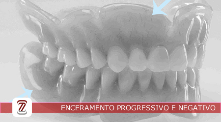 TEC.20222.66.02 - Enceramento Progressivo e Negativo
